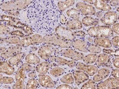 Immunohistochemistry-Paraffin: GPI7 Antibody [NBP2-98099]