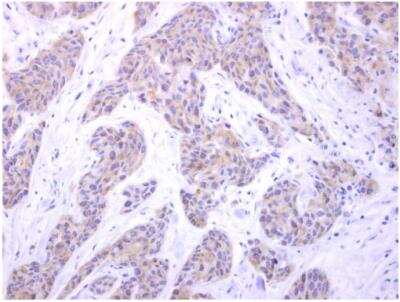 Immunohistochemistry-Paraffin: GPI8 Antibody [NBP1-31564]