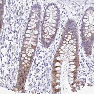 Immunohistochemistry-Paraffin: GPI8 Antibody [NBP2-33782]