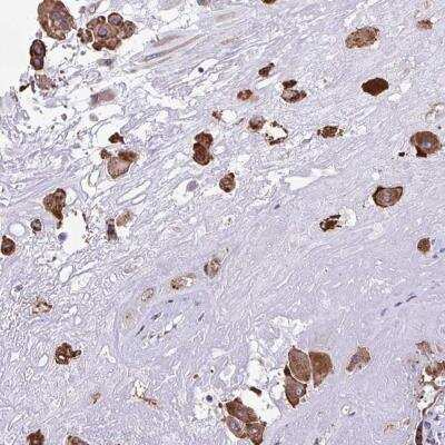 Immunohistochemistry-Paraffin: GPI8 Antibody [NBP2-33812]