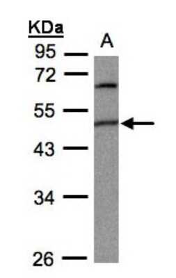 Western Blot: GPI8 Antibody [NBP1-31564]