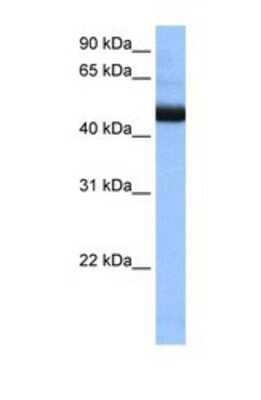 Western Blot: GPI8 Antibody [NBP1-69262]