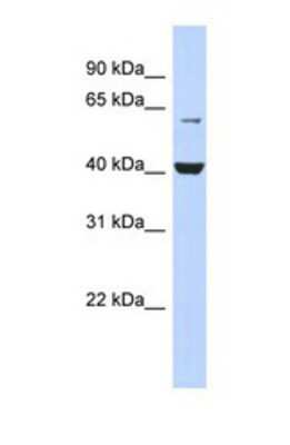 Western Blot: GPI8 Antibody [NBP1-69263]