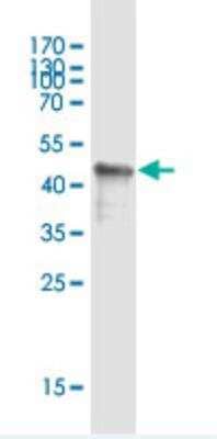 Western Blot: GPIHBP1 Antibody (1F9) [H00338328-M02]