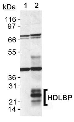 Western Blot: GPIHBP1 Antibody [NB110-55293]