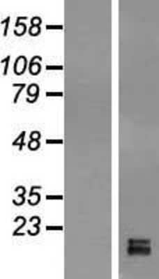 Western Blot: GPIHBP1 Overexpression Lysate [NBL1-11231]