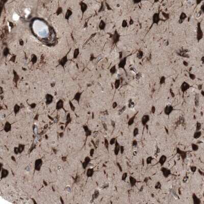Immunohistochemistry-Paraffin: GPIP137 Antibody [NBP1-88195]