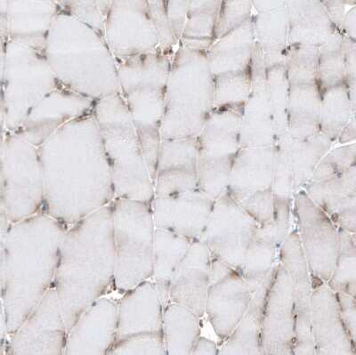 Immunohistochemistry-Paraffin: GPIP137 Antibody [NBP1-88195]