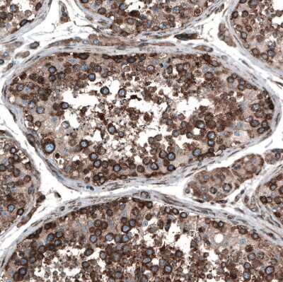 Immunohistochemistry-Paraffin: GPIP137 Antibody [NBP1-88195]