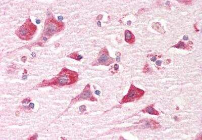 Immunohistochemistry-Paraffin: GPIP137 Antibody [NBP2-42504]