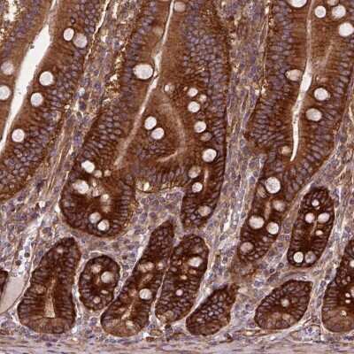 Immunohistochemistry-Paraffin: GPIP137 Antibody [NBP2-57388]