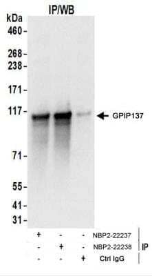 Immunoprecipitation: GPIP137 Antibody [NBP2-22237]