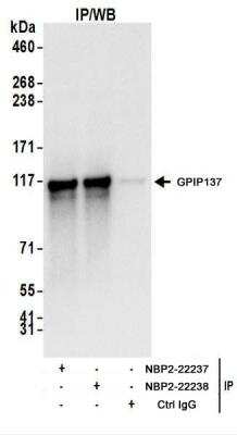 Immunoprecipitation: GPIP137 Antibody [NBP2-22238]