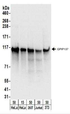 Western Blot: GPIP137 Antibody [NBP2-22237]