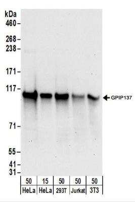 Western Blot: GPIP137 Antibody [NBP2-22238]