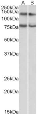 Western Blot: GPIP137 Antibody [NBP2-42504]