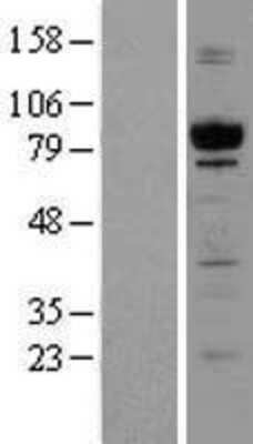 Western Blot: GPIP137 Overexpression Lysate [NBL1-08687]