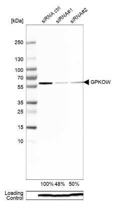 Knockdown Validated: GPKOW Antibody [NBP1-81800]