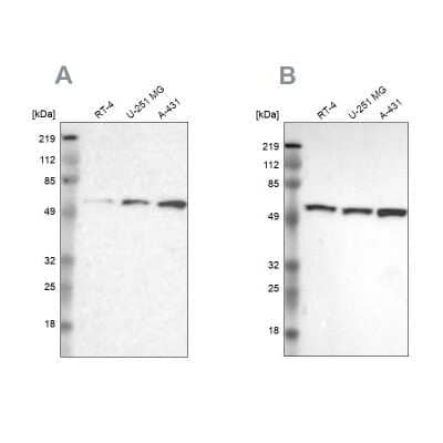 Western Blot: GPKOW Antibody [NBP1-81801]