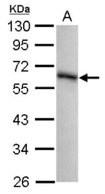 Western Blot: GPKOW Antibody [NBP2-16713]