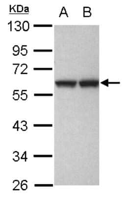 Western Blot: GPKOW Antibody [NBP2-16714]