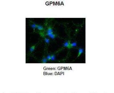 Immunohistochemistry: GPM6A Antibody [NBP2-85000]