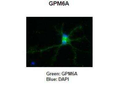 Immunohistochemistry: GPM6A Antibody [NBP2-85000]