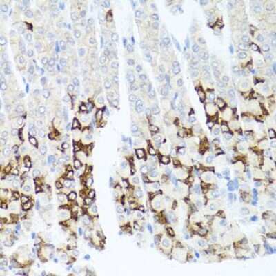 Immunohistochemistry-Paraffin: GPM6A Antibody - BSA Free [NBP3-03901]