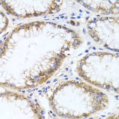 Immunohistochemistry-Paraffin: GPM6A Antibody - BSA Free [NBP3-03901]