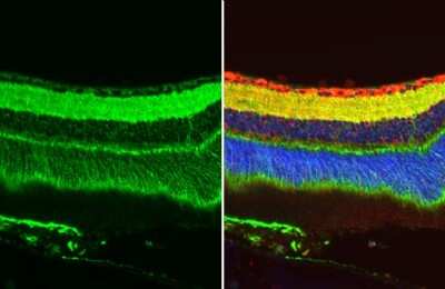 Immunohistochemistry-Paraffin: GPM6A Antibody [NBP3-13410]
