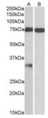 Western Blot: GPM6A Antibody [NBP1-68861]