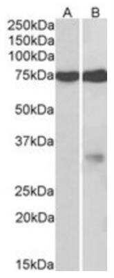 Western Blot: GPM6A Antibody [NBP1-68861]