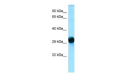 Western Blot: GPM6A Antibody [NBP2-85000]