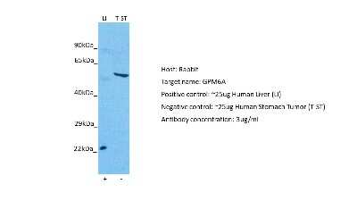 Western Blot: GPM6A Antibody [NBP2-85000]