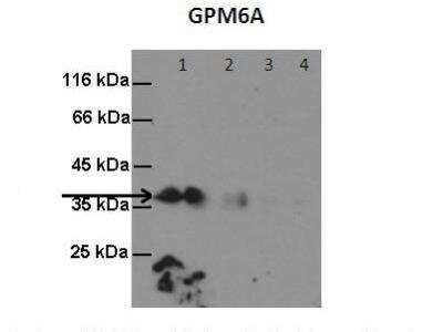Western Blot: GPM6A Antibody [NBP2-85000]