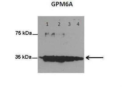 Western Blot: GPM6A Antibody [NBP2-85000]