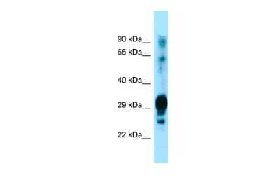 Western Blot: GPM6A Antibody [NBP2-85001]