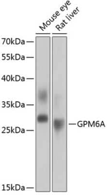 Western Blot: GPM6A AntibodyBSA Free [NBP3-04744]