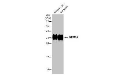 Western Blot: GPM6A Antibody [NBP3-13410]