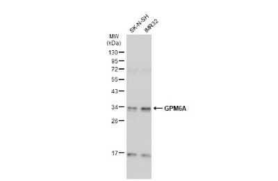 Western Blot: GPM6A Antibody [NBP3-13410]