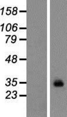 Western Blot: GPM6A Overexpression Lysate [NBP2-10116]