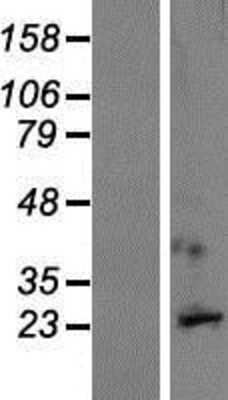 Western Blot: GPM6A Overexpression Lysate [NBP2-10117]