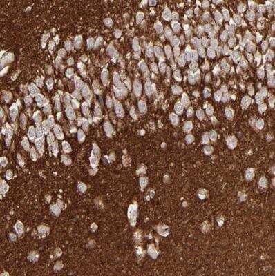 Immunohistochemistry-Paraffin: GPM6B Antibody [NBP1-81271]