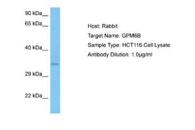 Western Blot: GPM6B Antibody [NBP2-82921]