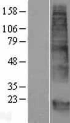 Western Blot: GPM6B Overexpression Lysate [NBP2-08970]