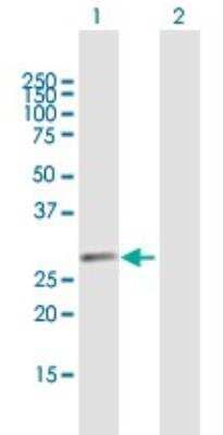 Western Blot: GPN2 Antibody [H00054707-B03P]