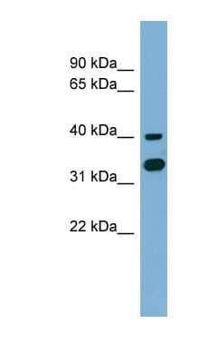 Western Blot: GPN2 Antibody [NBP1-55359]