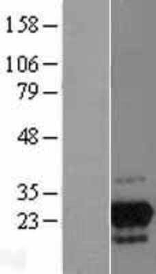 Western Blot: GPN2 Overexpression Lysate [NBL1-11237]