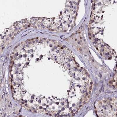 Immunohistochemistry-Paraffin: GPN3 Antibody [NBP2-30372]