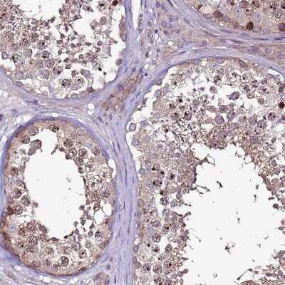 Immunohistochemistry-Paraffin: GPN3 Antibody [NBP2-30665]